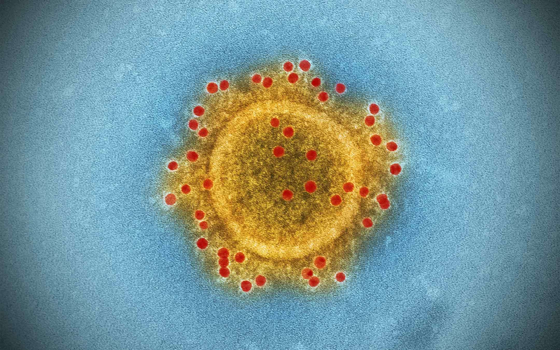 Coronavirus, le parole sono importanti: pandemia