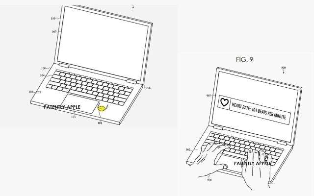 MacBook sanitario