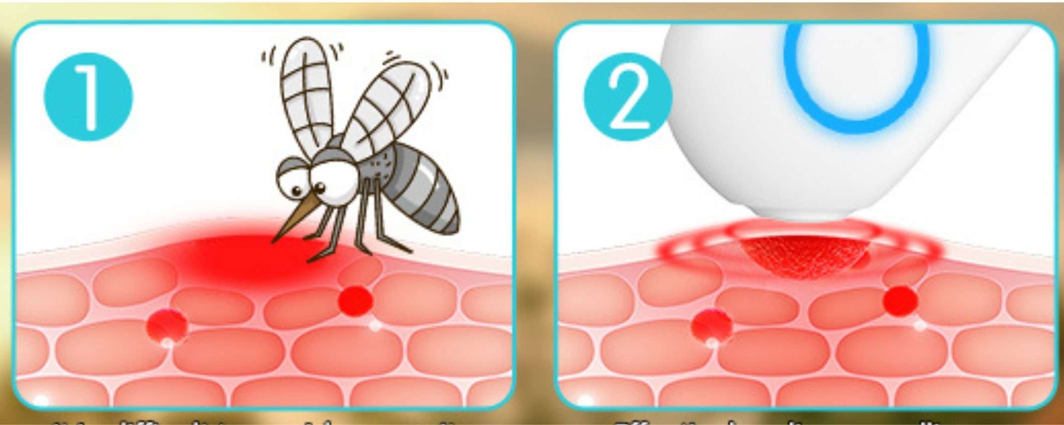 Puntura di zanzara SOLLIEVO immediato: dispositivo ricaricabile a 12€ (-50%) Puntura di zanzara SOLLIEVO immediato: dispositivo ricaricabile a 12€ (-50%)