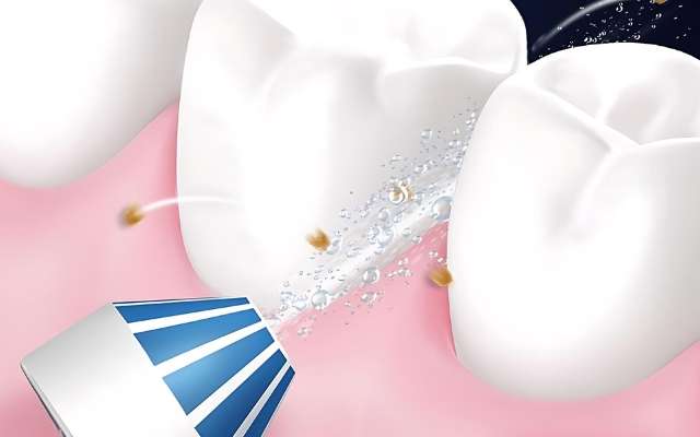 idropulsore-oral-b